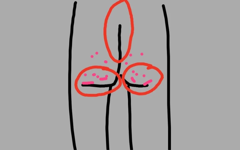 Alt Image