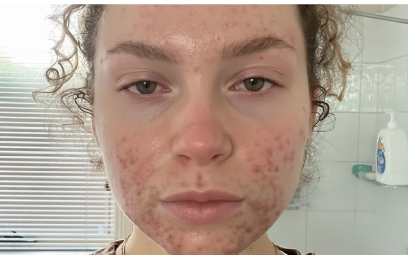 Alt Image